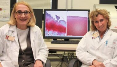 Osteoartrosi, nella lotta ecco la nuova ricerca dell’istituto Rizzoli 