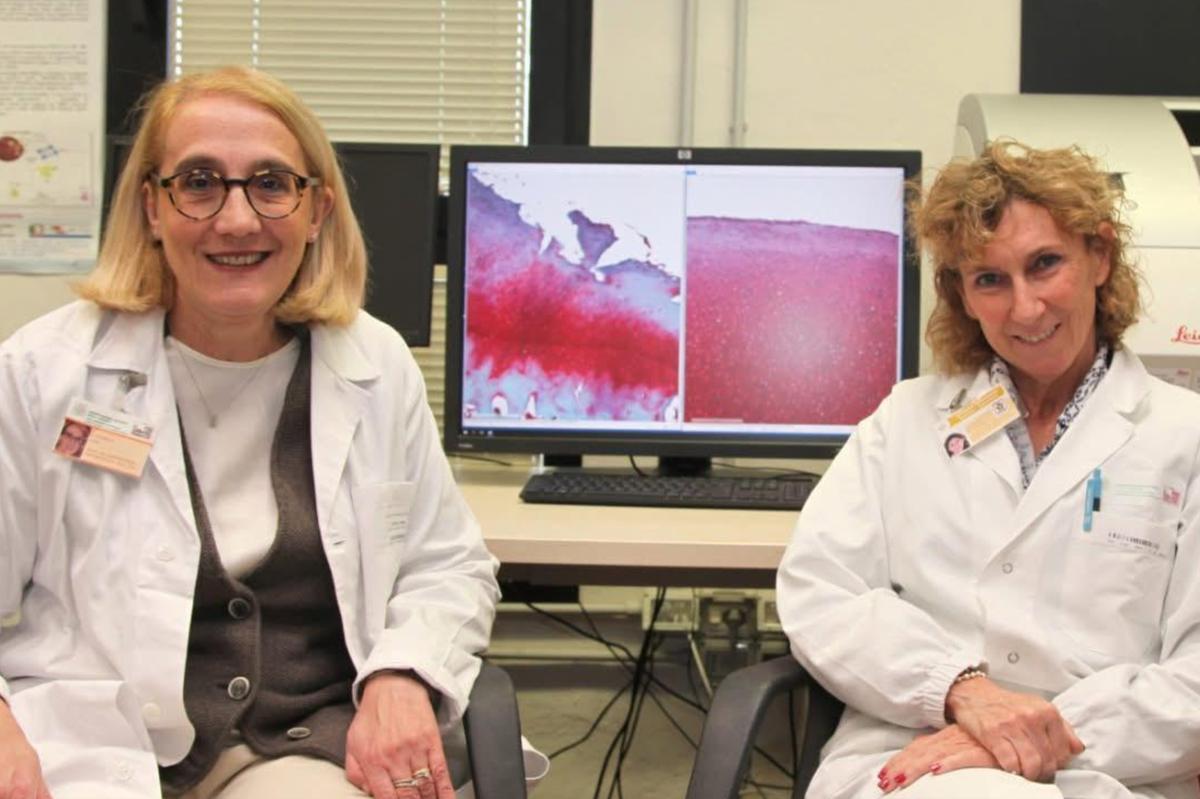 Osteoartrosi, nella lotta ecco la nuova ricerca dell’istituto Rizzoli 