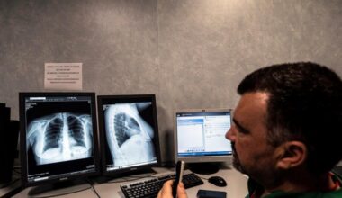 Tumore seno, cresce l'adesione allo screening ma divario Nord-Sud - Focus Tumore news