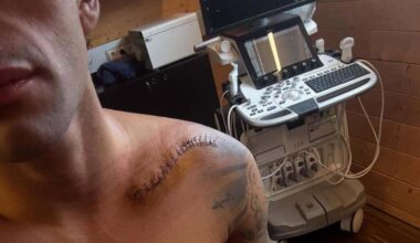 MotoGP 2025, Jorge Martin sulle orme di Marc Marquez: riabilitazione al Red Bull Athlete Performance Center [GALLERY] - MotoGP