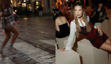 "Mezza gamba spaccata e piena di lividi. Non riuscivo ad alzarmi". Il racconto dell'incidente in strada è tragicomico