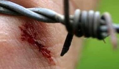 donna di mezza età costretta a un lungo ricovero in Rianimazione