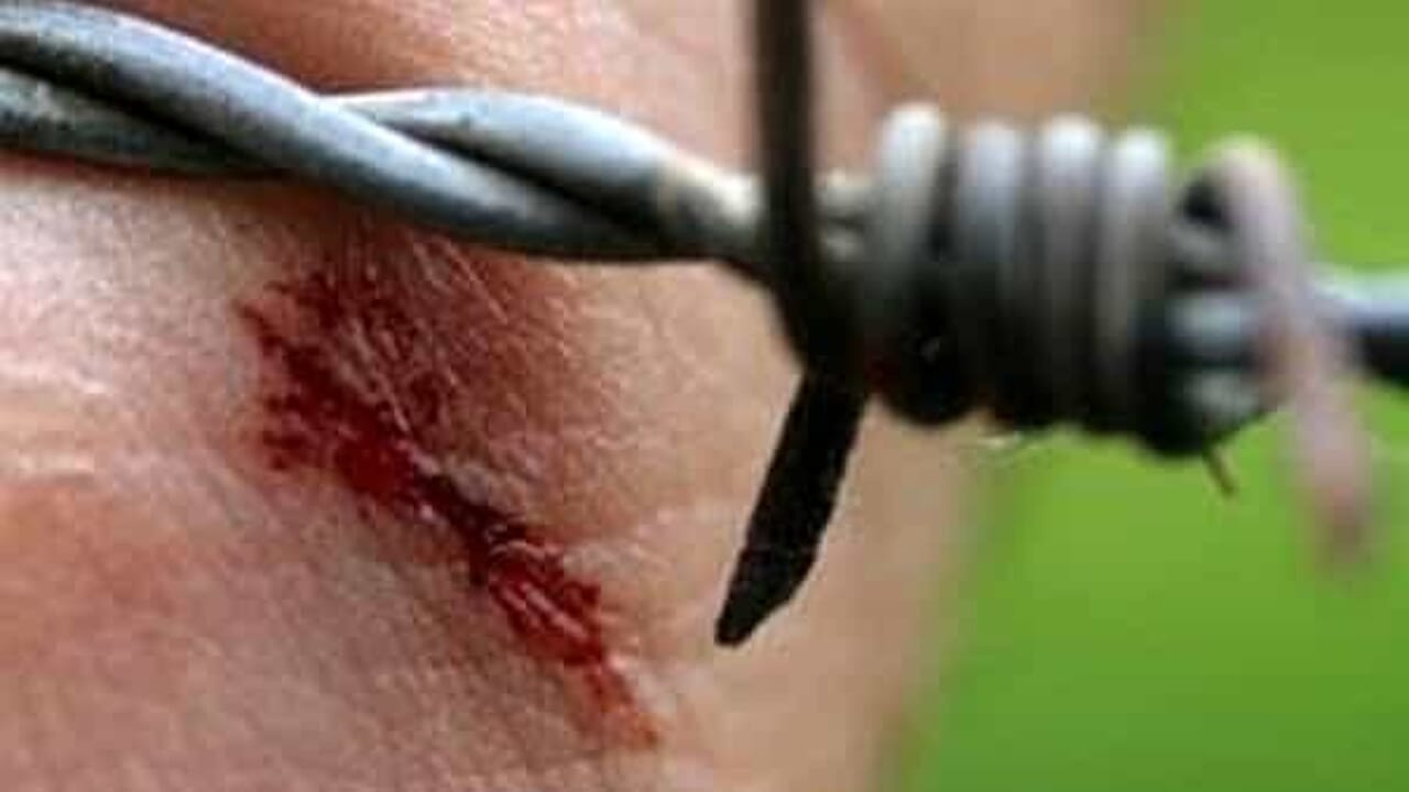 donna di mezza età costretta a un lungo ricovero in Rianimazione