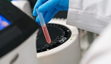 Infarto, arriva il “tritest”: con tre esami del sangue sapremo chi è a maggior rischio