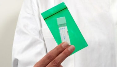 screening per la diagnosi del colon retto, "last call" per i nati nel 1951