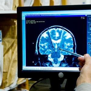 Pressione alta che non scende? Potrebbe nascere (anche) nel cervello