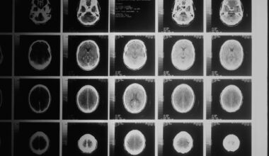 Cancro, quali sono i 4 sintomi "insoliti" da non sottovalutare