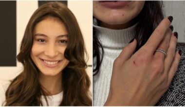 “Nessuno mi ha aiutato, mi sono salvata con lo spray al peperoncino”