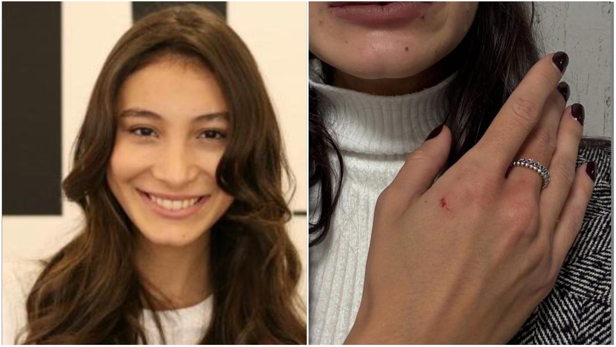 “Nessuno mi ha aiutato, mi sono salvata con lo spray al peperoncino”