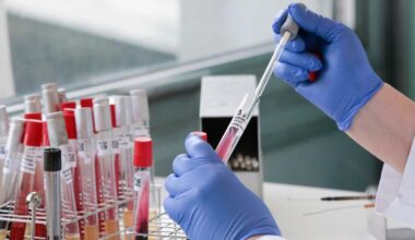 Neurologia, in aumento le patologie infiammatorie e autoimmuni del sistema nervoso