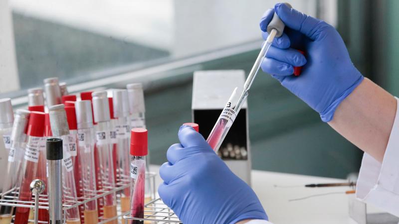 Neurologia, in aumento le patologie infiammatorie e autoimmuni del sistema nervoso