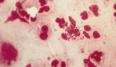 L'Oms lancia l'allerta, sempre più preoccupazione per la Gonorrea: "È resistente agli antibiotici"