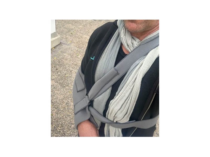 CADUTA IN BICI, FRATTURA DEL TROCHITE OMERALE PER GARZELLI