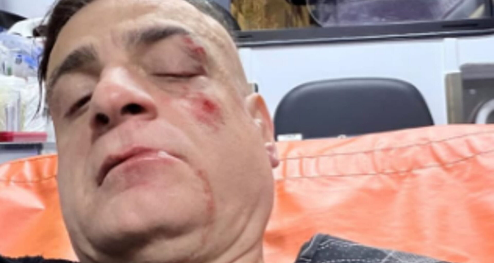 Simone Cicalone aggredito alla stazione metro Ottaviano. L’influencer: “Erano in dieci contro uno”