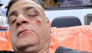 Simone Cicalone aggredito alla stazione metro Ottaviano. L’influencer: “Erano in dieci contro uno”