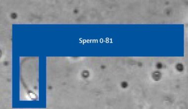 La prima gravidanza con l'Intelligenza artificiale: «Ha trovato gli unici due spermatozoi "attivi" di un 39enne e 13 giorni dopo la compagna era incinta»