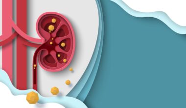 Calcoli renali e coliche, che cosa fare per scongiurarli e perché provocano un dolore così intenso