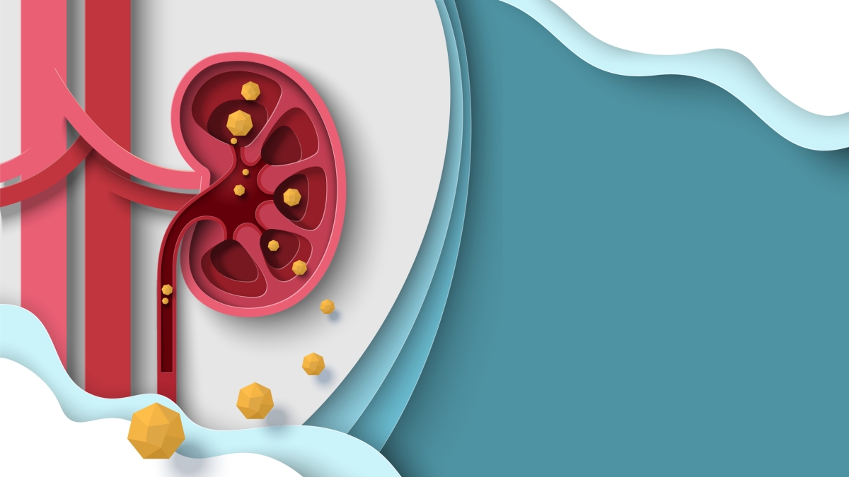 Calcoli renali e coliche, che cosa fare per scongiurarli e perché provocano un dolore così intenso