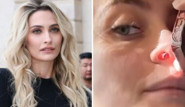 Paris Jackson mostra il setto nasale perforato dall'abuso di droga: «Mi ha rovinato la vita»