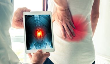 Problemi alla schiena: quando è davvero indicato l'intervento chirurgico (che resta comunque l'ultima spiaggia)