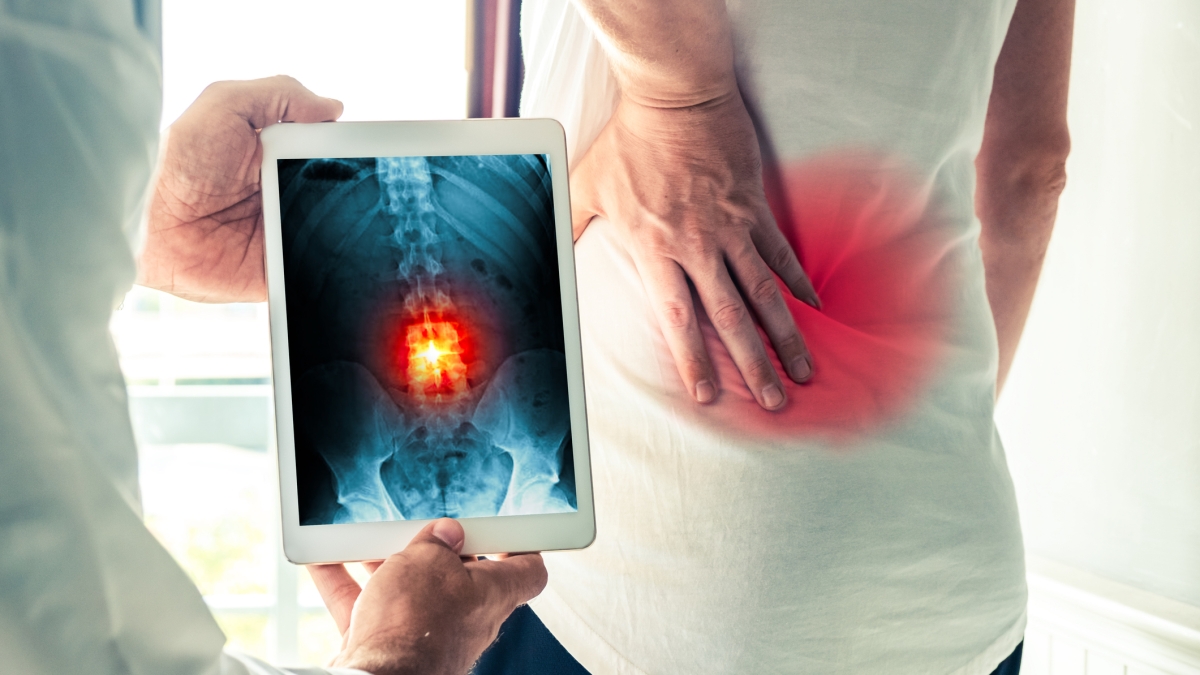 Problemi alla schiena: quando è davvero indicato l'intervento chirurgico (che resta comunque l'ultima spiaggia)