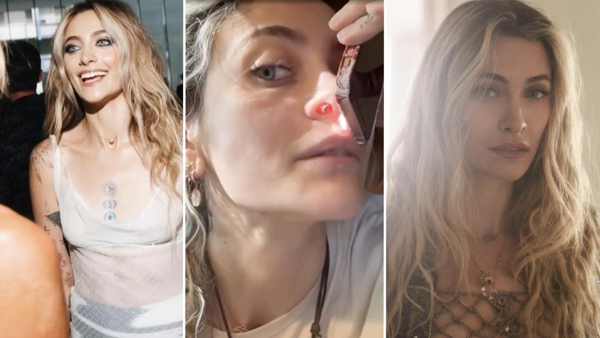 Paris Jackson, setto nasale perforato da droghe: le foto shock