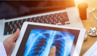 Tumore al polmone: l'esame che può salvare la vita a chi è più a rischio. Tac spirale una volta l'anno ai forti fumatori o ex