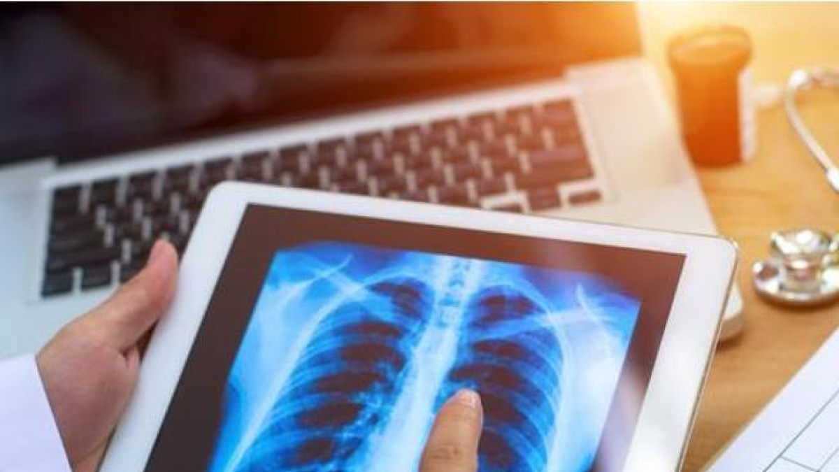 Tumore al polmone: l'esame che può salvare la vita a chi è più a rischio. Tac spirale una volta l'anno ai forti fumatori o ex