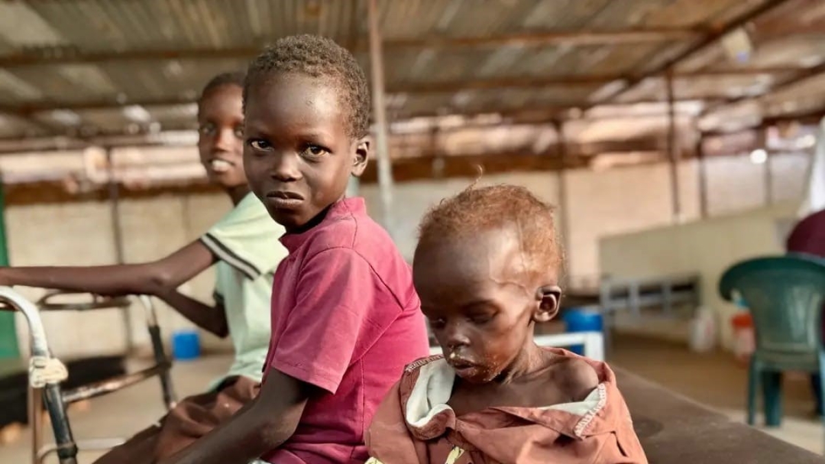 I bambini quasi vivi del Sudan: così la piccola Huatin si è salvata con i fratellini. «A 2 anni pesava 5 chili. Ora ha perso anche la mamma»