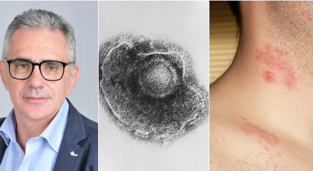 «Attenzione agli occhi». Sintomi, cause, cure e come avviene il contagio