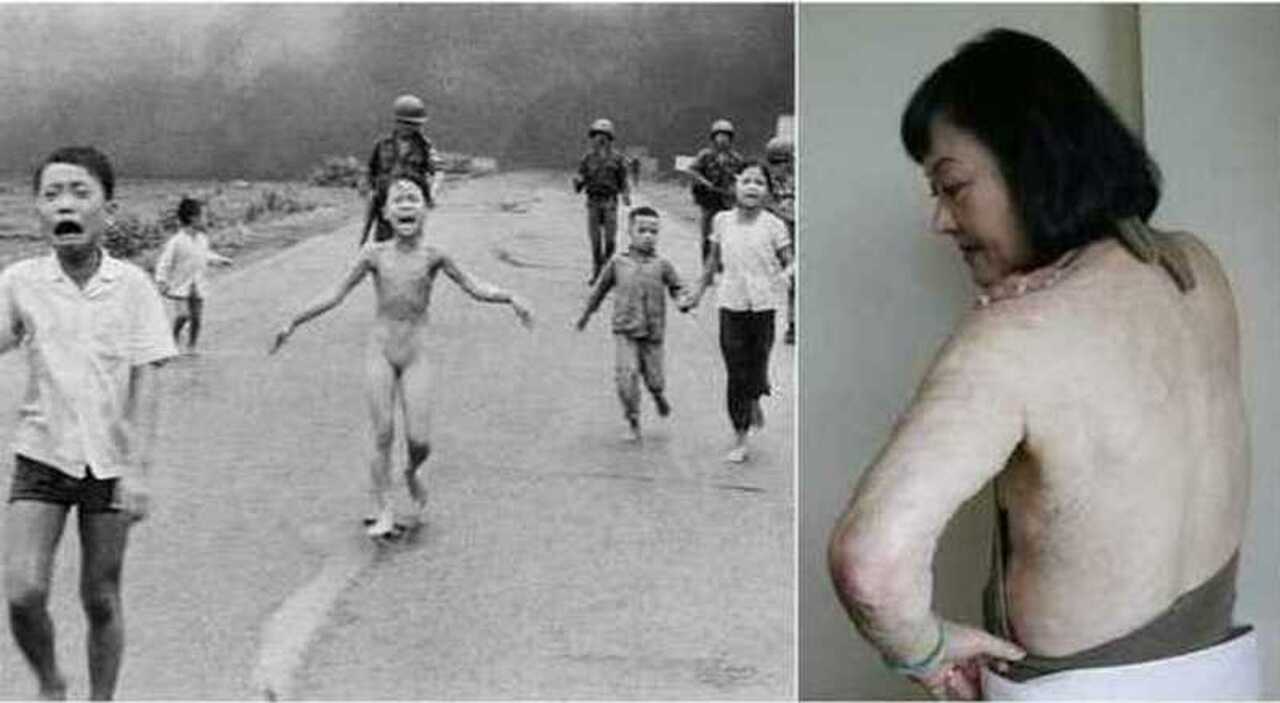 Napalm Baby, Netflix rilancia i dubbi sullo scatto che vinse il premio Pulitzer. Nick Ut, il freelance e la nuova versione