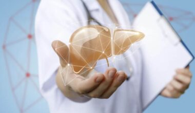 La MASLD, comunemente nota come "fegato grasso", è una condizione caratterizzata dall’accumulo di grasso nel fegato in assenza di abuso alcolico significativo.