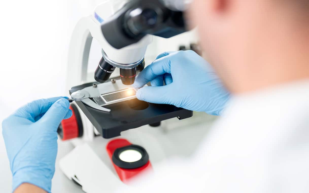 Antibiotico resistenza, ogni anno 12mila morti in Italia: la guida dell'Iss