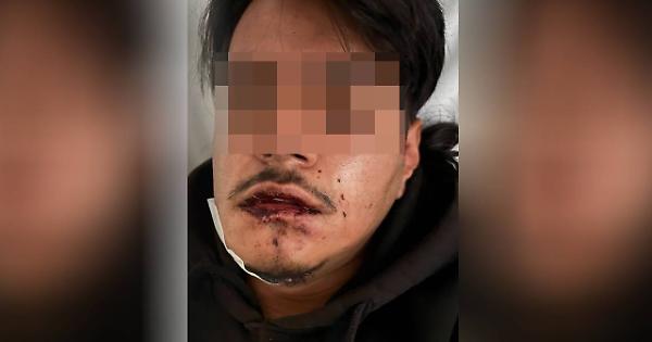 Ivan, 20 anni, esce con gli amici e viene pestato dalla baby-gang in piazza Castello - Torino Cronaca