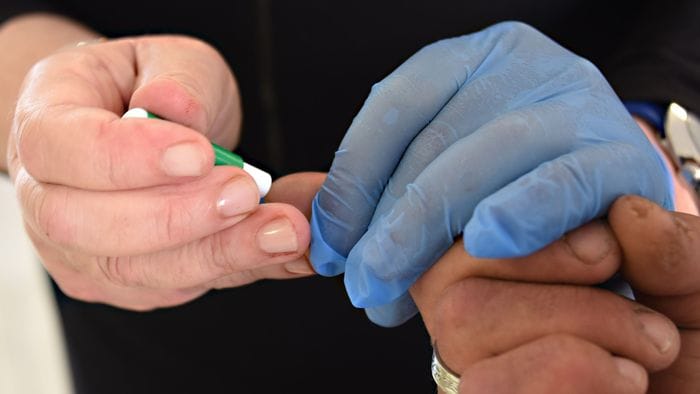 Aids a Bergamo: «Diagnosi tardive, serve prevenzione»