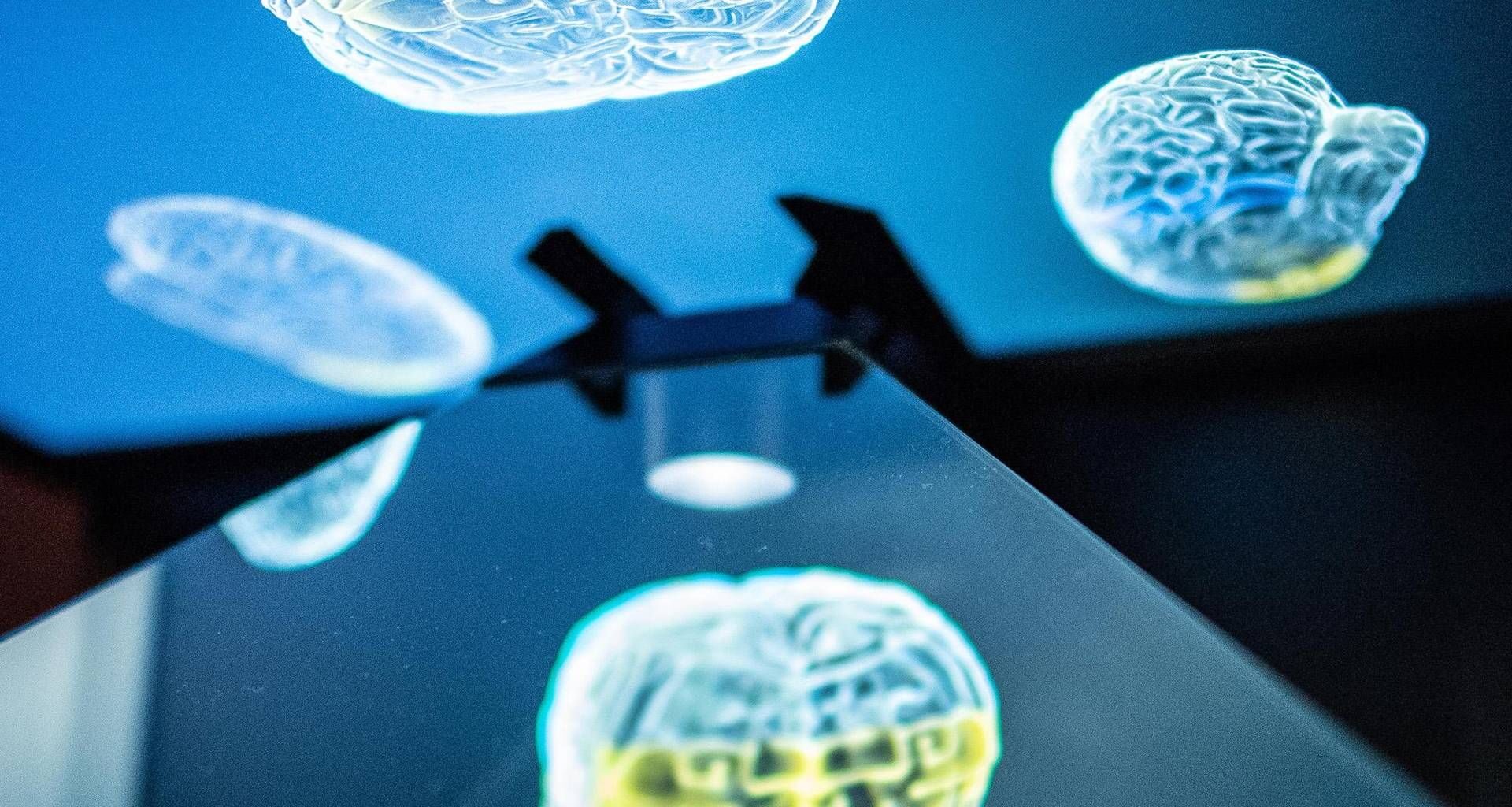 il sorprendente effetto della dieta sul cervello