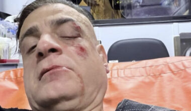 La polizia dopo 2 settimane non riesce a trovare gli aggressori di Cicalone. L'ipotesi della fuga all'estero