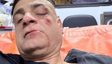 Cicalone aggredito in metro a Roma: come sta lo youtuber