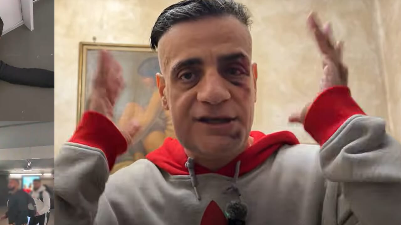 il racconto dello youtuber in un video. Su whatsapp le immagini (non censurate) dell'aggressione