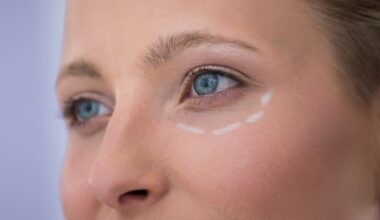 Novembre è il mese delle occhiaie, i rimedi naturali per eliminare questi aloni scuri: spariranno subito