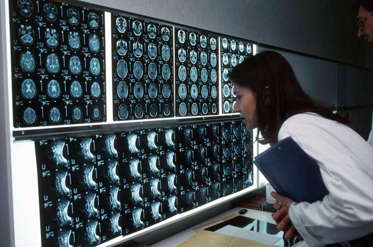 Cancro, l'allarme nascosto. Quattro sintomi insoliti che svelano il tumore