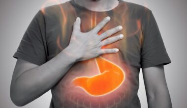 I consigli in tv del professor Carlo Fabbri per il reflusso gastroesofageo: sintomi, diagnosi e cura