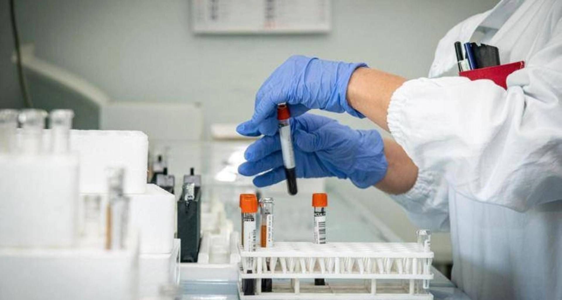 sesso e alimenti, come si prende e sintomi