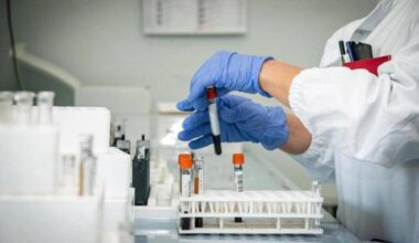 sesso e alimenti, come si prende e sintomi