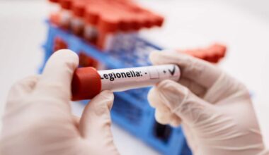 Legionella a Milano, test confermano 11 casi e un decesso