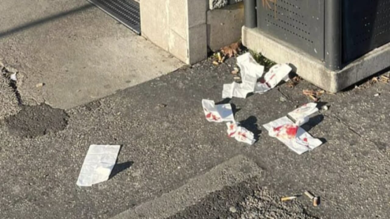 "Mi hanno tagliato volto e collo"