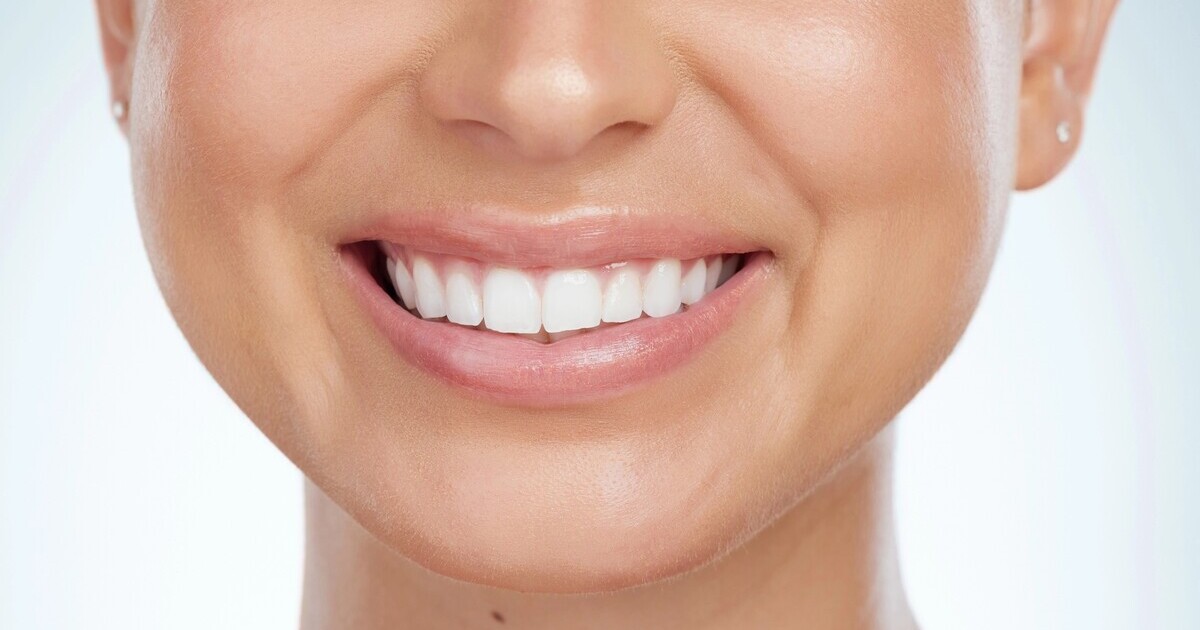 Rigenerare lo smalto dei denti è possibile: sviluppato un gel bioispirato che ricrea lo smalto naturale