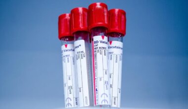 Ecco l’esame del sangue che può prevedere 14 tipi di cancro: come funziona il test 