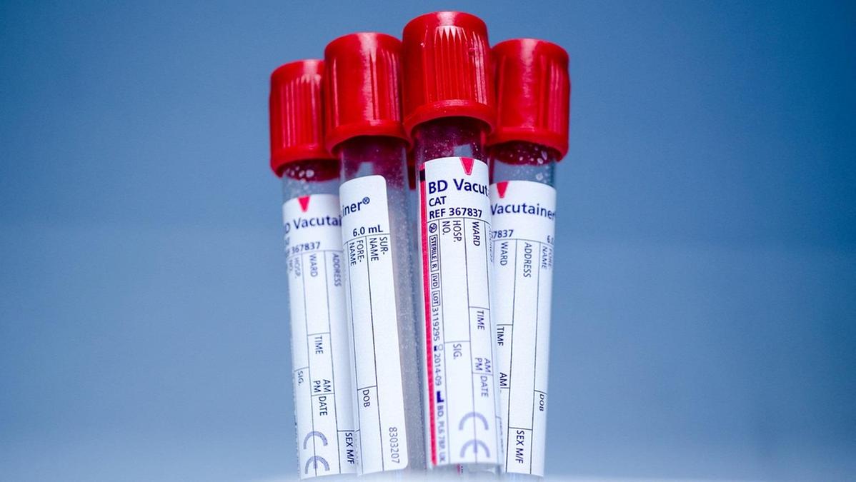 Ecco l’esame del sangue che può prevedere 14 tipi di cancro: come funziona il test 