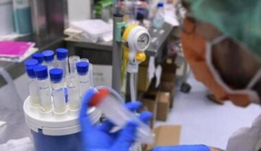 Legionella a Milano, analisi acquedotto in corso: una casa è positiva